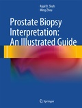Cover: Prostate Biopsy Interpretation: An Illustrated Guide - Springer