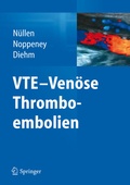 Bild: VTE - Venöse Thromboembolien - Springer