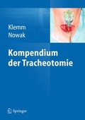 Cover: Kompendium der Tracheotomie - Springer