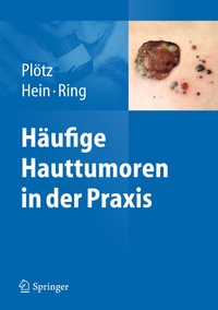 Abbildung von: Häufige Hauttumoren in der Praxis - Springer
