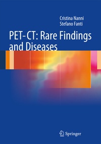 Abbildung von: PET-CT: Rare Findings and Diseases - Springer