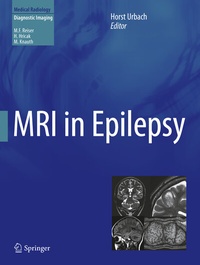 Abbildung von: MRI in Epilepsy - Springer