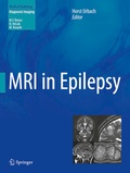 Cover: MRI in Epilepsy - Springer