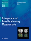 Cover: Osteoporosis and Bone Densitometry Measurements - Springer