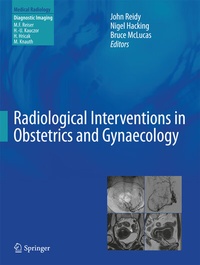 Abbildung von: Radiological Interventions in Obstetrics and Gynaecology - Springer