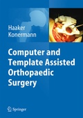 Cover: Computer and Template Assisted Orthopedic Surgery - Springer