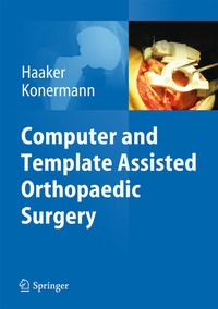Enlarge image Cover: Computer and Template Assisted Orthopedic Surgery - Springer