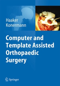 Enlarge image Cover: Computer and Template Assisted Orthopedic Surgery - Springer