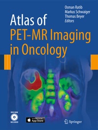 Abbildung von: Atlas of PET/MR Imaging in Oncology - Springer