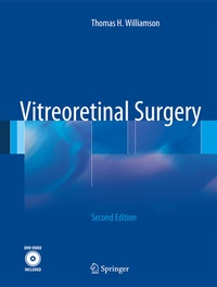 Abbildung von: Vitreoretinal Surgery - Springer