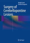 Cover: Surgery of Cerebellopontine Lesions - Springer