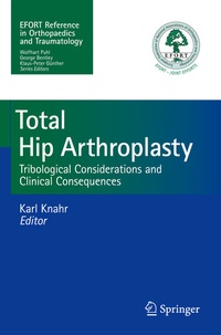 Abbildung von: Total Hip Arthroplasty - Springer