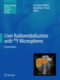 Cover: Liver Radioembolization with 90Y Microspheres - Springer