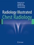 Cover: Radiology Illustrated: Chest Radiology - Springer