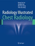 Cover: Radiology Illustrated: Chest Radiology - Springer