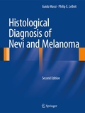 Cover: Histological Diagnosis of Nevi and Melanoma - Springer