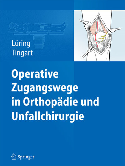 Abbildung von: Operative Zugangswege in Orthopädie und Unfallchirurgie - Springer