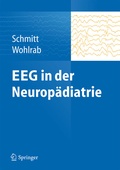 Abbildung von: EEG in der Neuropädiatrie - Springer