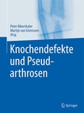 Cover: Knochendefekte und Pseudarthrosen - Springer