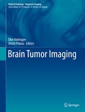 Abbildung von: Brain Tumor Imaging - Springer