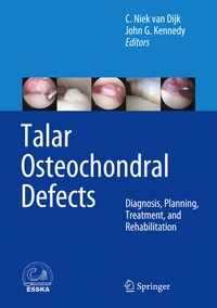 Abbildung von: Talar Osteochondral Defects - Springer