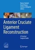Cover: Anterior Cruciate Ligament Reconstruction - Springer