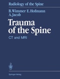 Cover: Trauma of the Spine - Springer
