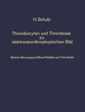 Cover: Thrombocyten und Thrombose im elektronenmikroskopischen Bild / Electron Microscopy of Blood Platelets and Thrombosis - Springer