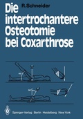 Cover: Die intertrochantere Osteotomie bei Coxarthrose - Springer