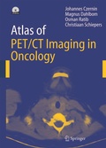 Cover: Atlas of PET/CT Imaging in Oncology - Springer