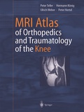 Cover: MRI Atlas of Orthopedics and Traumatology of the Knee - Springer