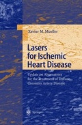 Bild: Lasers for Ischemic Heart Disease - Springer