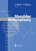 Cover: Shoulder Arthroplasty - Springer