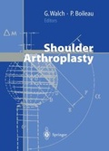 Cover: Shoulder Arthroplasty - Springer