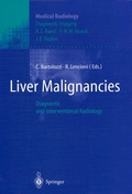 Cover: Liver Malignancies - Springer