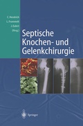 Cover: Septische Knochen-und Gelenkchirurgie - Springer