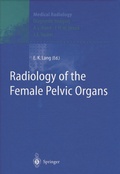 Cover: Radiology of the Female Pelvic Organs - Springer