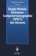 Bild: Single-Photon-Emissions-Computertomographie (SPECT) des Herzens - Springer