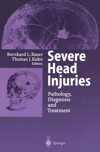 Enlarge image Cover: Severe Head Injuries - Springer