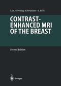 Cover: Contrast-Enhanced MRI of the Breast - Springer