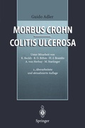 Cover: Morbus Crohn - Colitis ulcerosa - Springer