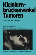 Cover: Kleinhirnbr&uuml;ckenwinkel-Tumoren - Springer