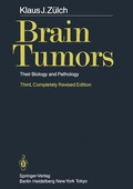 Cover: Brain Tumors - Springer