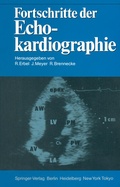 Cover: Fortschritte der Echokardiographie - Springer
