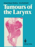 Cover: Tumours of the Larynx - Springer