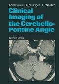Cover: Clinical Imaging of the Cerebello-Pontine Angle - Springer