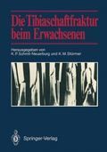 Cover: Die Tibiaschaftfraktur beim Erwachsenen - Springer