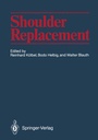 Cover: Shoulder Replacement - Springer