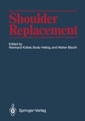 Cover: Shoulder Replacement - Springer