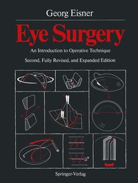 Enlarge image Cover: Eye Surgery - Springer